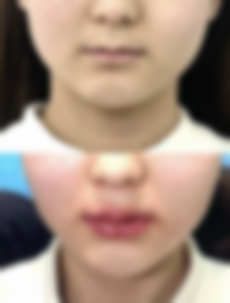 市面上祛疤膏的“选秀大会”