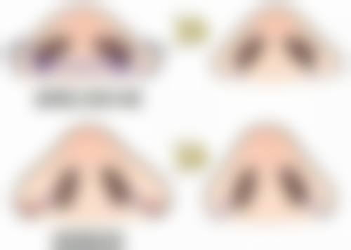 怎么样按摩眼睛去眼袋之下眼皮按摩：消除“小水袋”