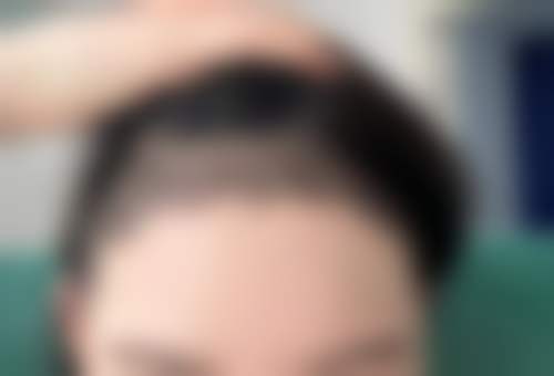 昆明雍禾植发医院价格表