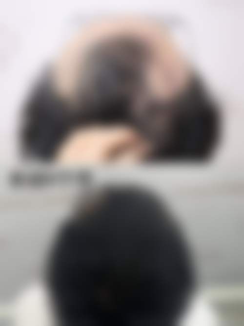 昆明雍禾植发医院地址及乘车路线