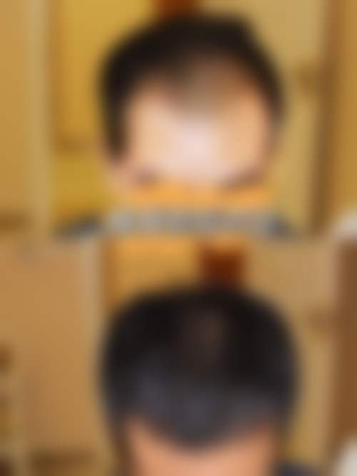 昆明雍禾植发医院项目特色