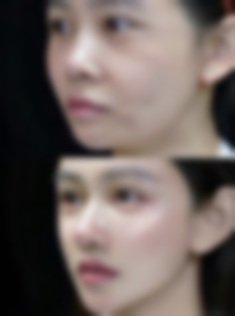 埋线双眼皮常见护理误区之越早化妆越好