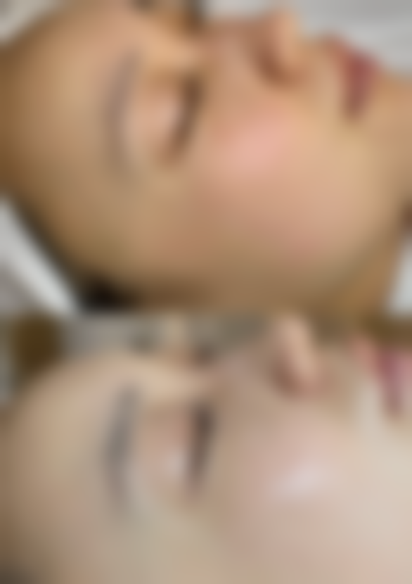 李月辉医生顾客实例图片