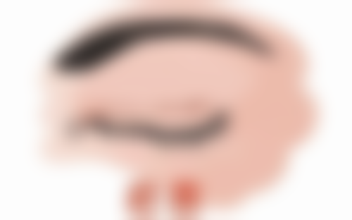 切开法双眼皮：持久塑形成效好的具有影响力医院推荐