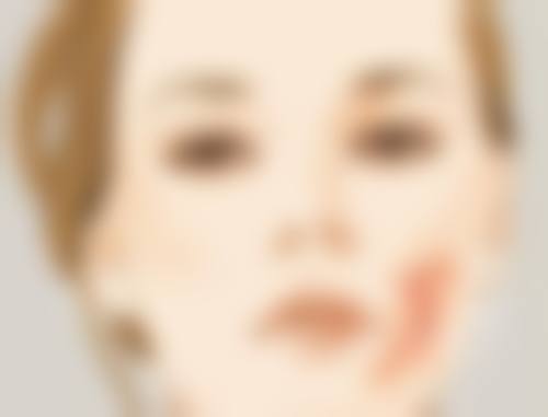 熬夜有黑眼圈眼袋怎么消除:常见误区