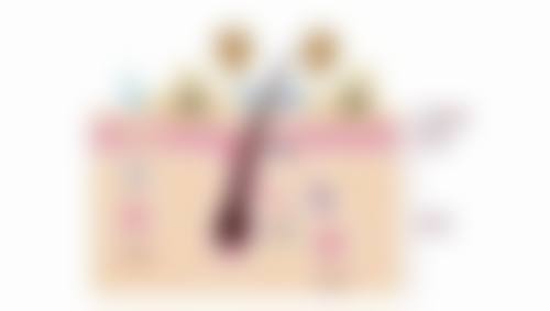 熬夜有黑眼圈眼袋怎么消除:长期保养计划