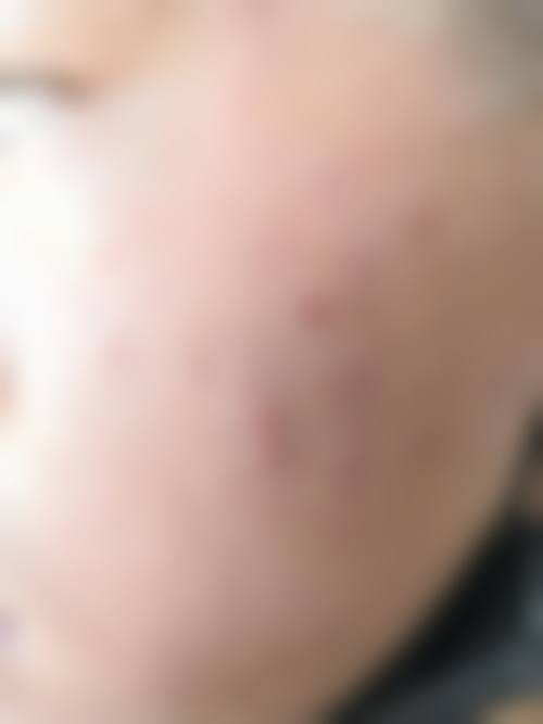 江门颜究院整形医院真实患者口碑评价