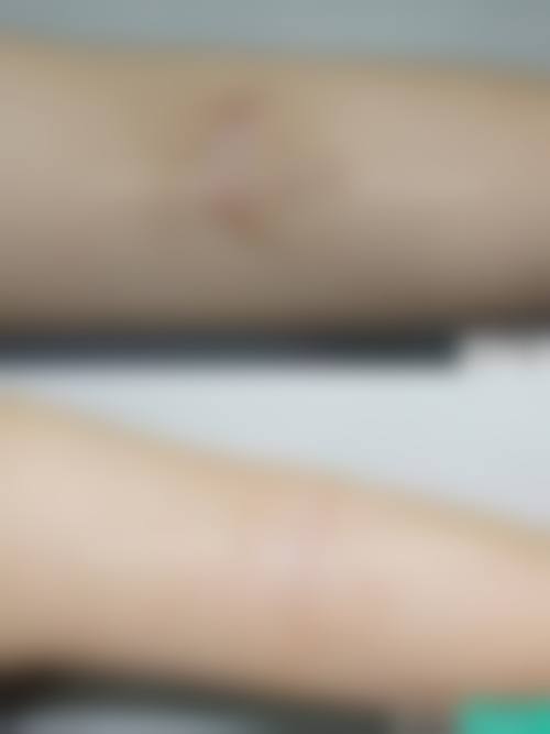 胡吉贵医生做手术价格