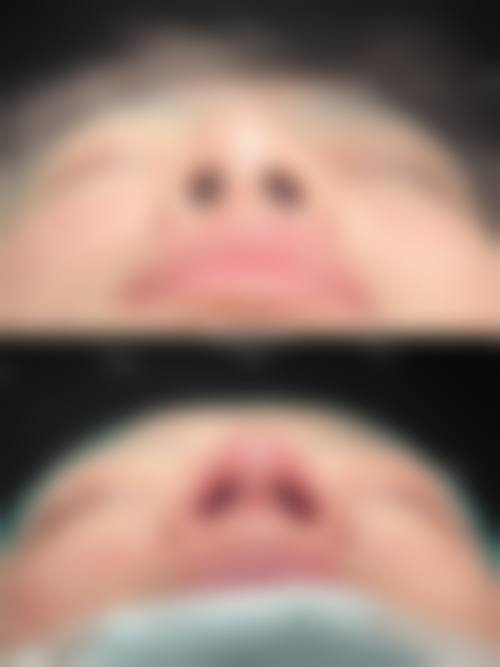 武汉五洲莱美整形医院——微整形注射实力强劲