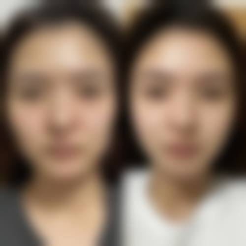 常熟市第一人民医院烧伤整形科价格表