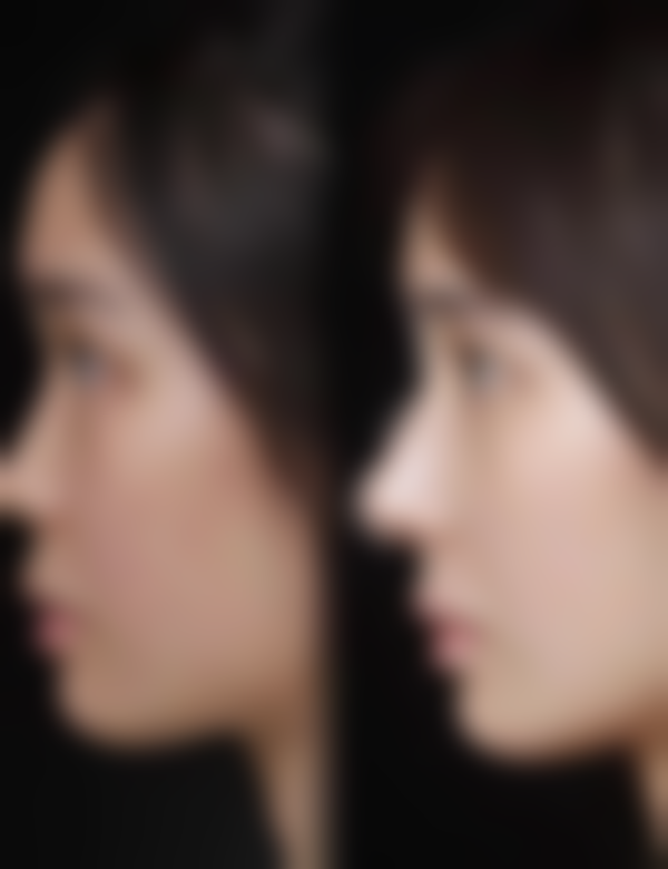 长沙卓恩医疗美容诊所怎么样，更擅长什么手术