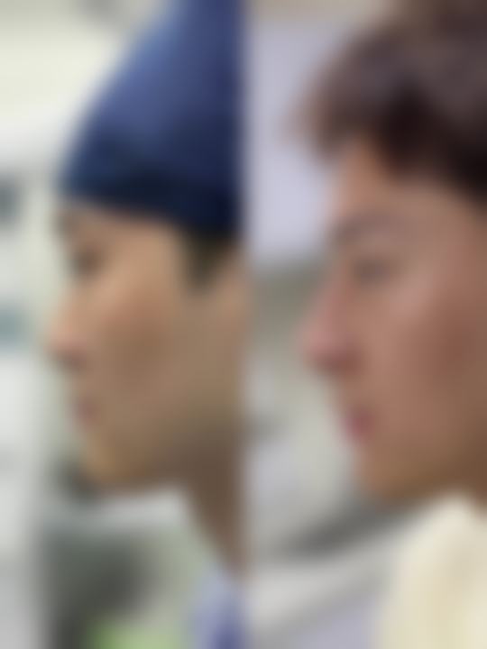 盛飞医生做手术价格