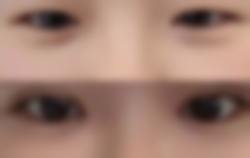 黄健勇医生做手术价格分析