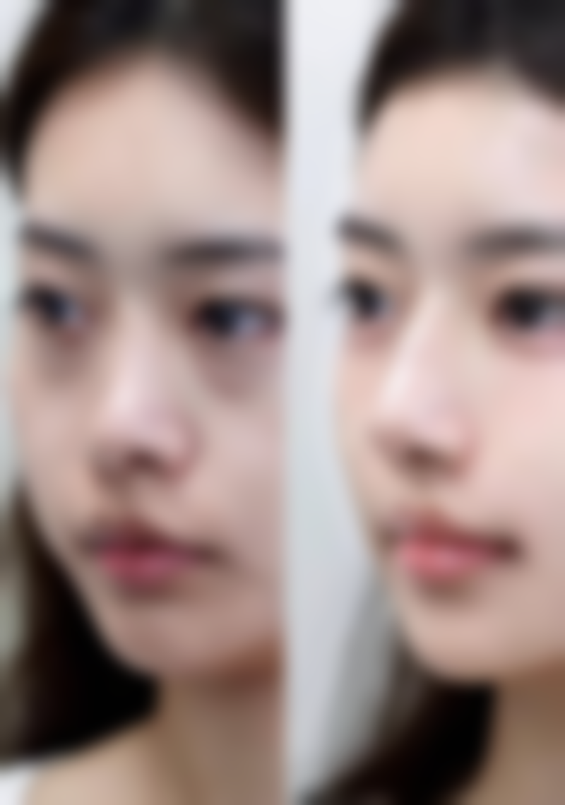 蔡增林医生：擅长脑血管及神经变性疾病骨干医生