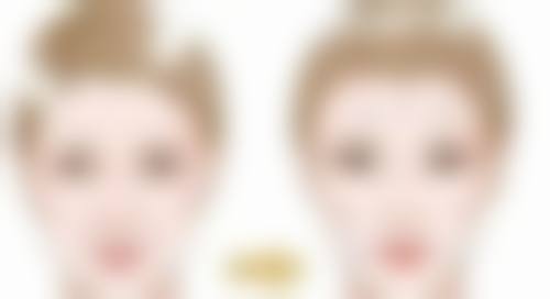 怎样去掉烧伤的疤痕:药物祛疤之软膏注射双管齐下