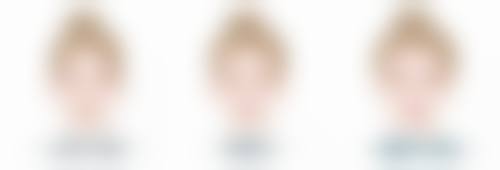 埋线双眼皮后多久可以洗脸:手术特点与护理技巧