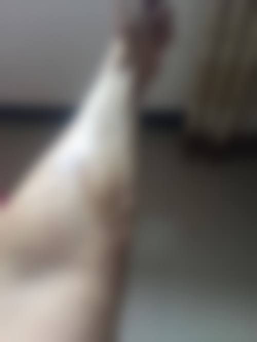 卿霞凤医生做手术价格