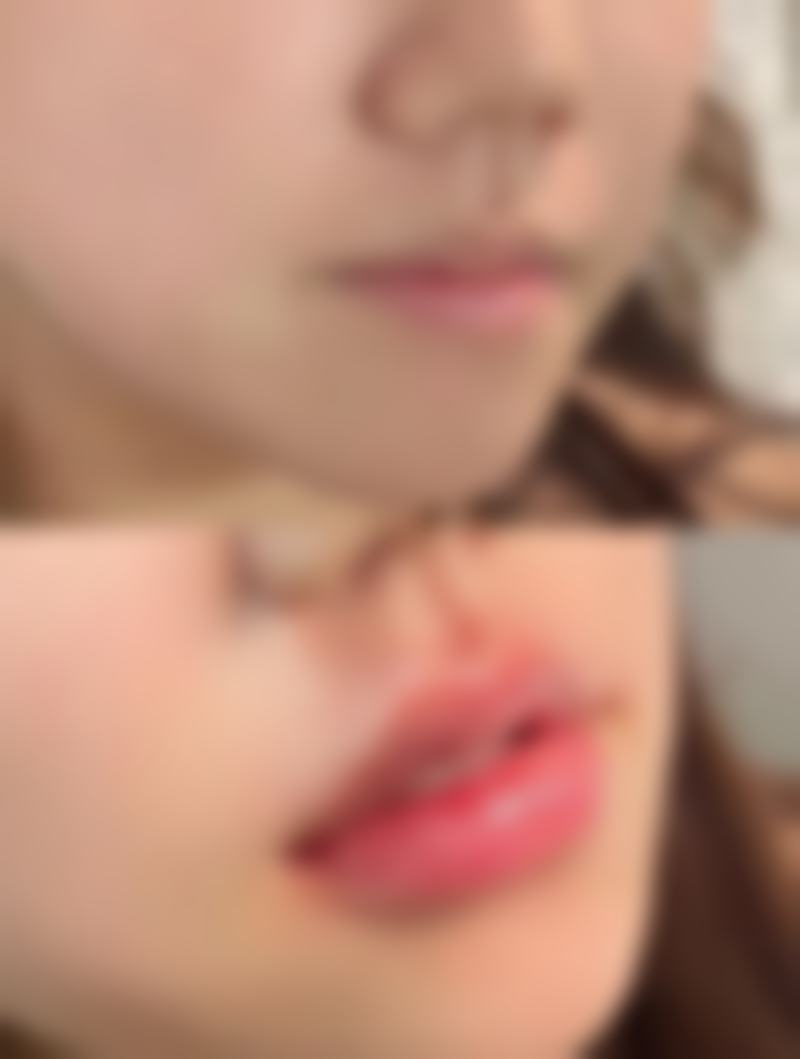 刀疤疤痕修复医院选择指南：选对医院事半功倍