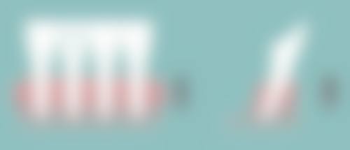 骨粉隆鼻取出的风险：了解风险，从容应对