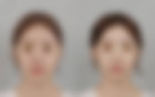 六、杭州悦可医疗美容诊所高寿松眼部整形档次