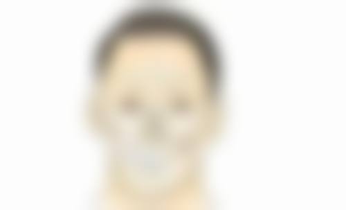 割完双眼皮后体质对修复自然的作用