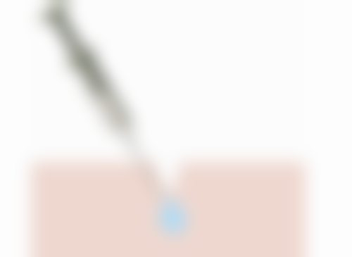 骨粉隆鼻取出的原因：关乎健康的必然选择