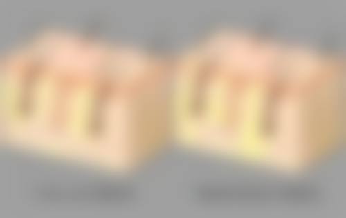 手术治疗选择应对顽固疤痕性痘痘