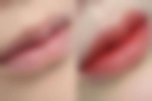 永定区张红医生技术成熟吗——广州壹加壹整形美容医院