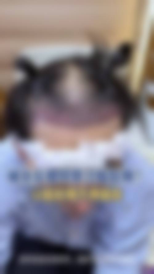 北京予馨美植发怎么样:是否正规及特色项目