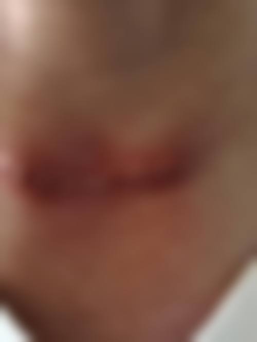 七、成都金牛柠萌整形医院口碑评价真实展示