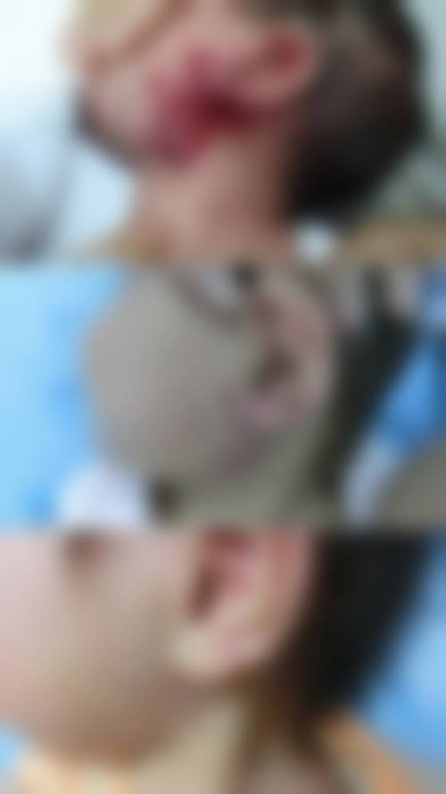 三、成都金牛柠萌整形医院口碑如何