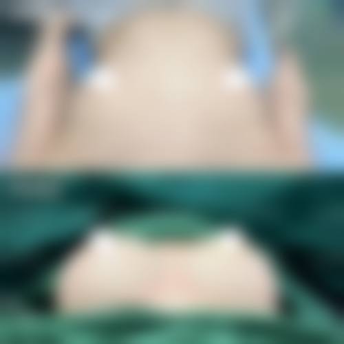 长春长青丽人医疗整形医院价格表