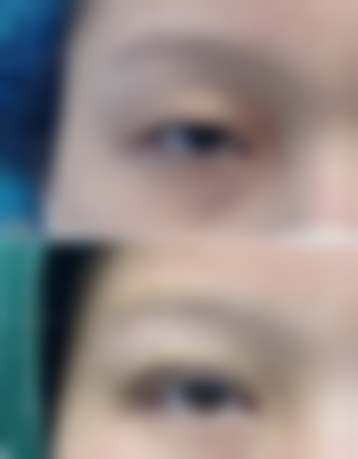 宁国市人民医院整形美容科怎么样，口碑评价如何？