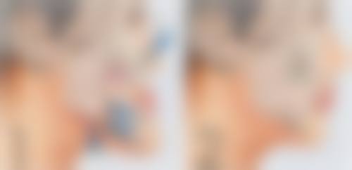 结语：告别眼袋，拥抱明亮未来