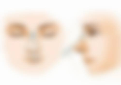 张国富医生简介做手术价格