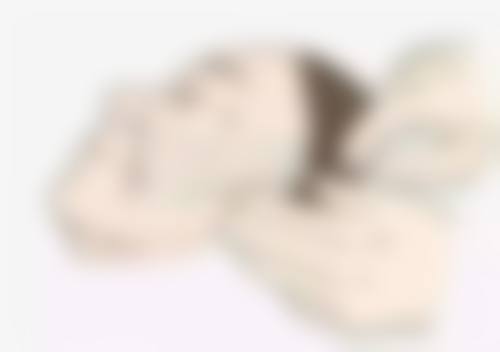 怎么样去除给下眼袋——遗传性眼袋的强力克星