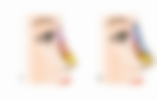 40岁女人眼袋怎么去：中医调理——内外兼修的“自然疗法”