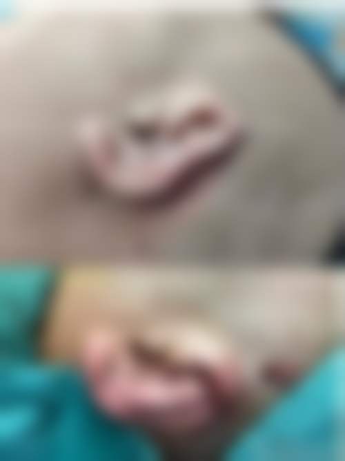 郝冬医生简介做手术价格