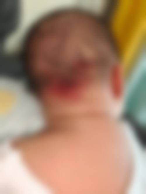 无锡同济整形医疗美容医院价格表