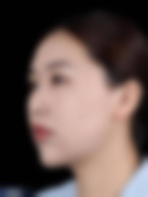 桐乡徐欣整形医院怎么样，口碑评价如何？