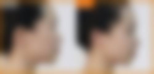 睢宁圣蓉医疗美容诊所怎么样，价格表