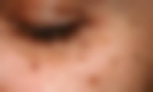 无锡同济整形医疗美容医院口碑评价