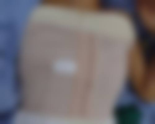 怎么把眼睛睡成双眼皮之睡前禁忌：抵御“美丽杀手”的侵袭