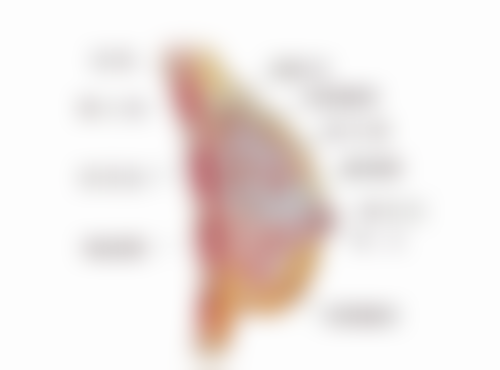 全身抽脂怎么抽的：仪器科技大揭秘