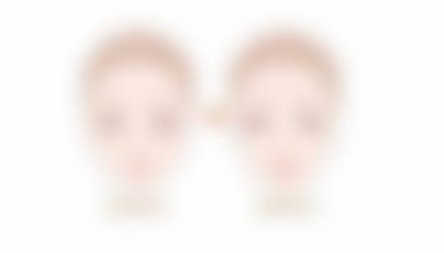 除眼袋之价格参考合理规划