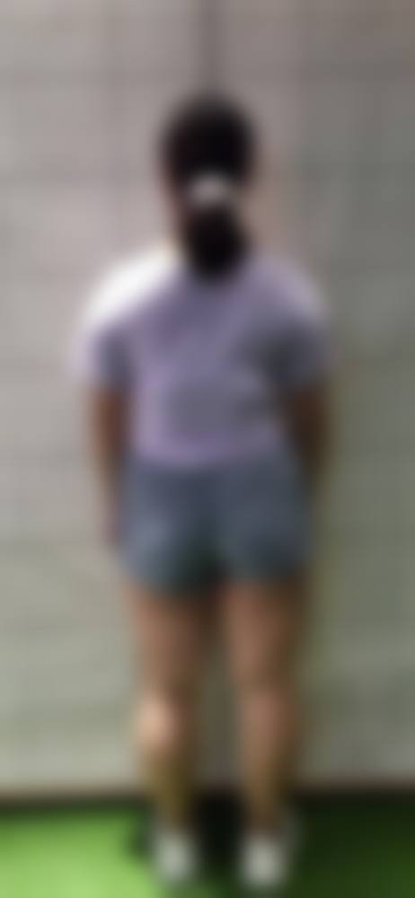 黄志鹏医生做手术价格详情