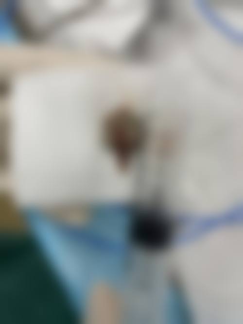 谢学峰医生口碑如何