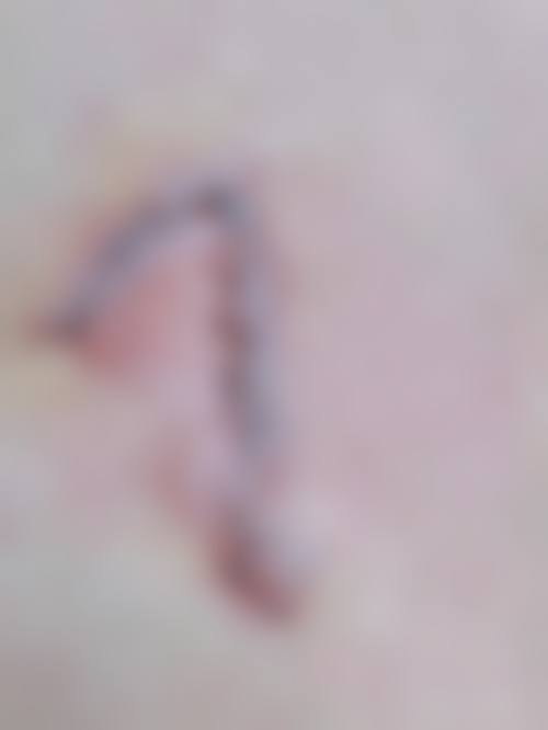 莆田解放军第95医院整形外科价格表