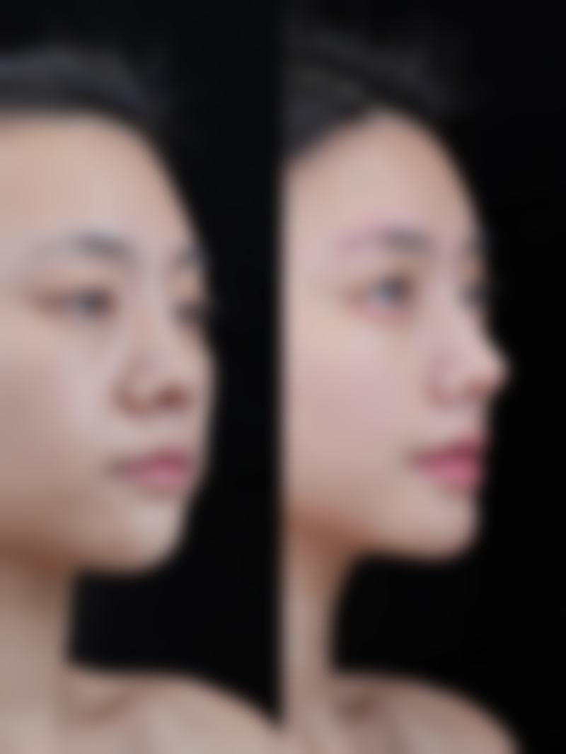 武汉斯启诺医疗美容门诊部叶锋眼综合项目解析