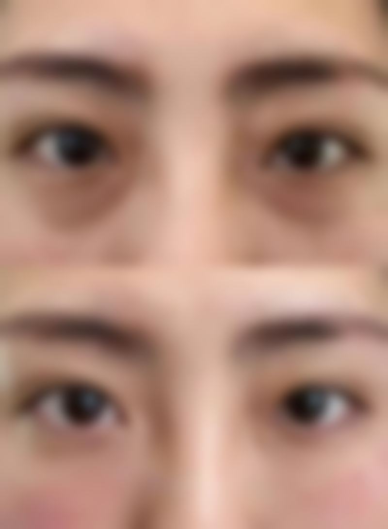 衢州梵星医疗美容门诊部顾客实例